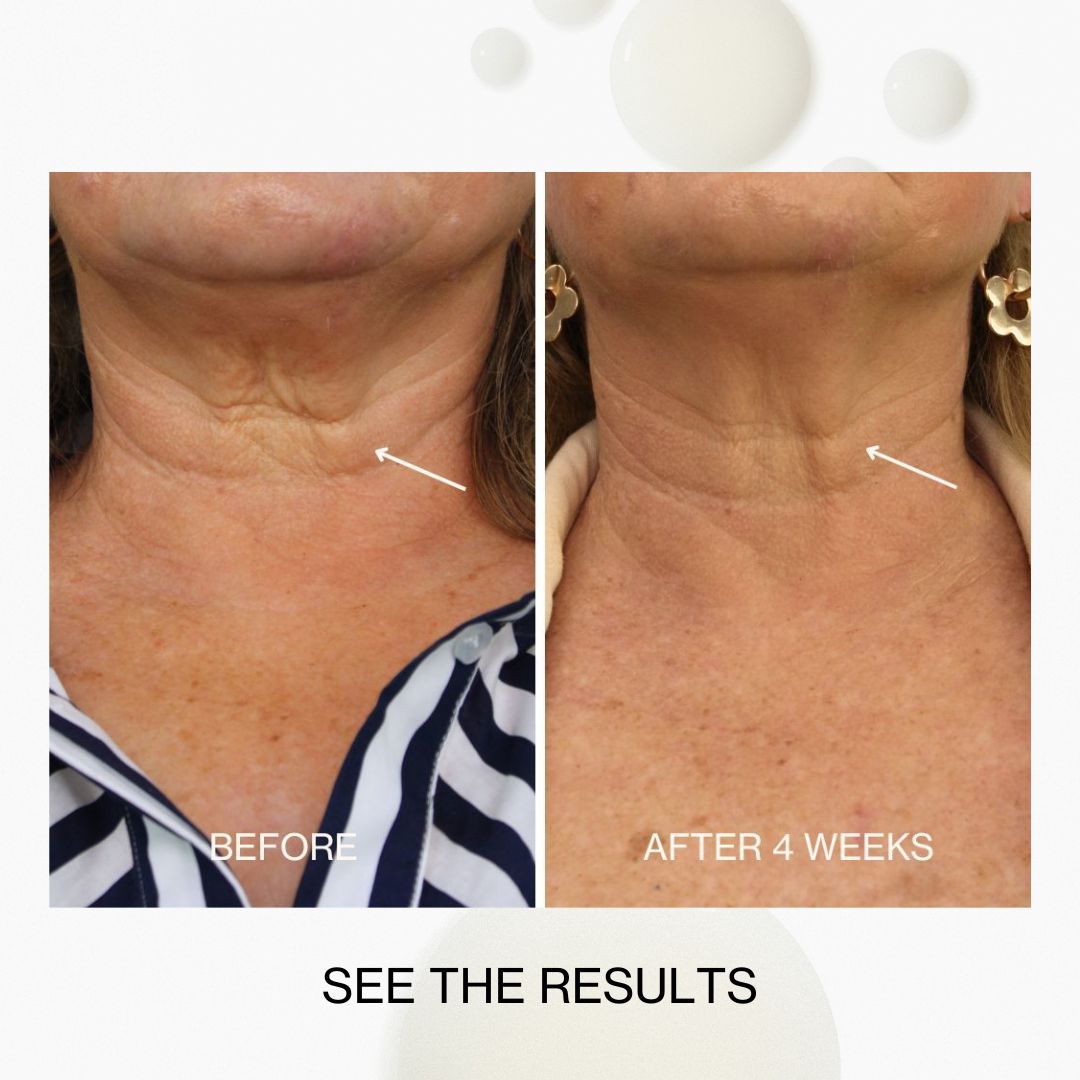 Jojoba Co Neck & Decolletage Lifting Concentrate