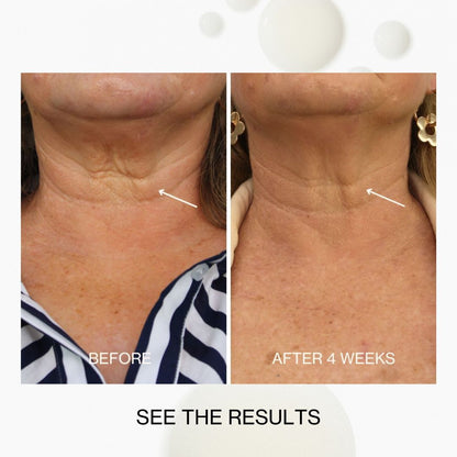 Jojoba Co Neck & Decolletage Lifting Concentrate
